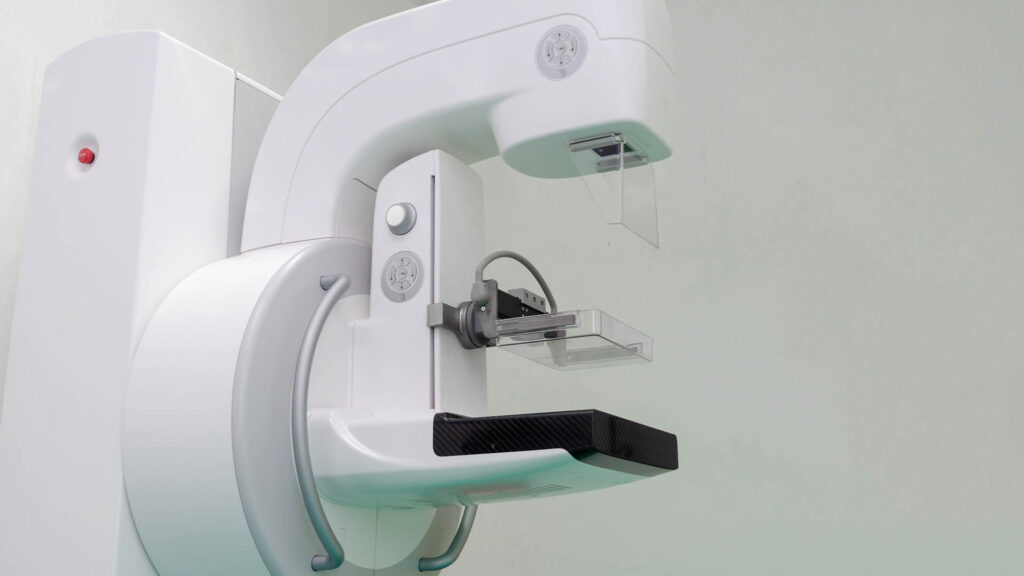 Digital Mammography X-Ray Machine